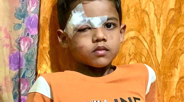 বায়ায় ক্লাসে শিশু শিক্ষার্থীর উপর খুলে পড়ল ফ্যান